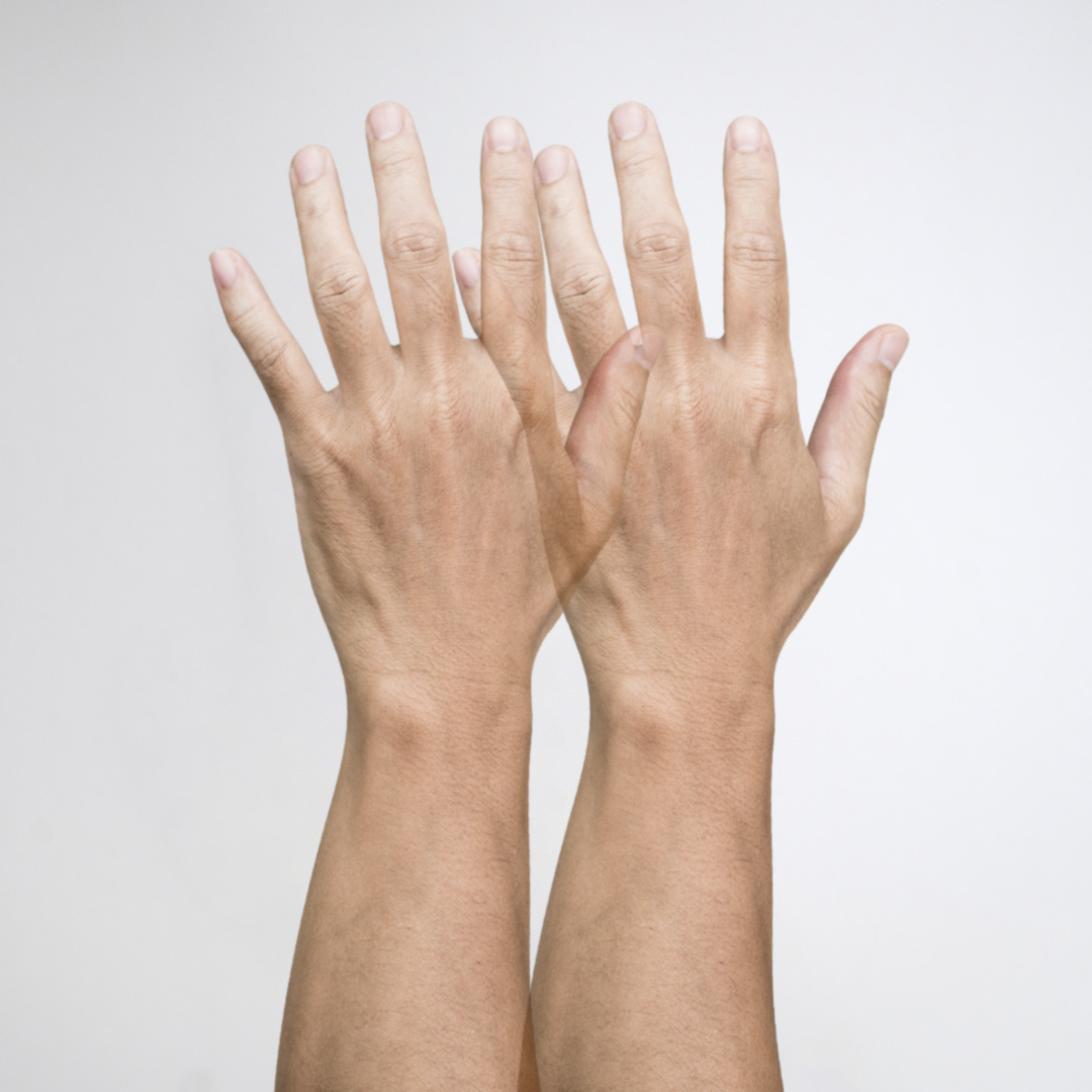 horizontalus dvejinimasis akyse