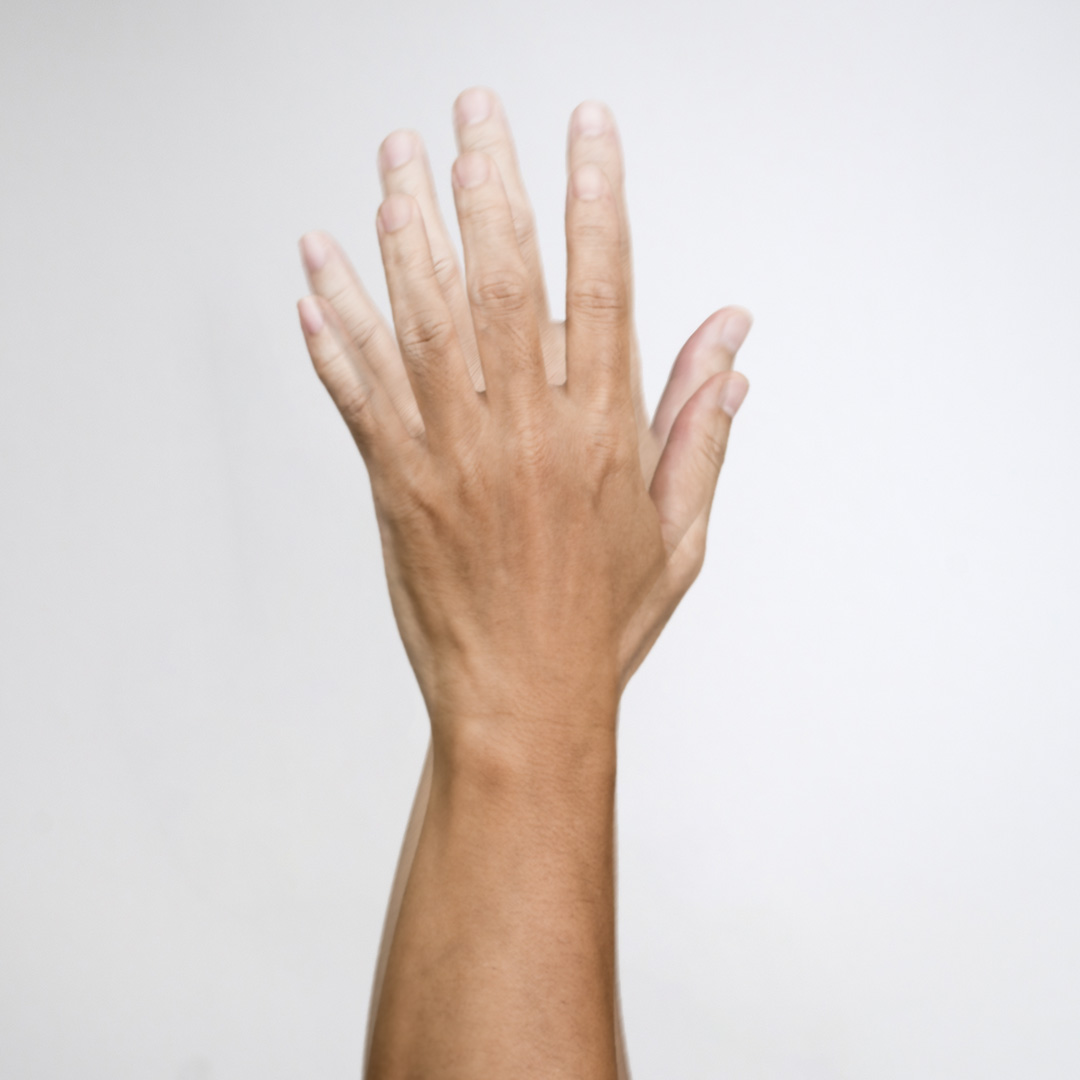 vertikalus dvejinimasis akyse