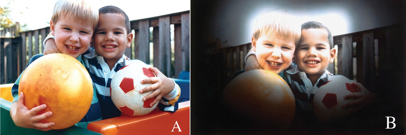 kaip mato žmonės, sergantys glaukoma